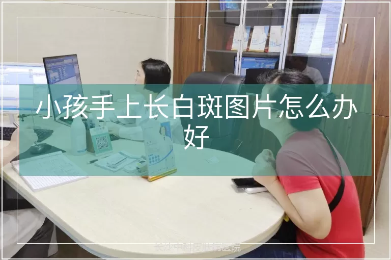 小孩手上长白斑图片怎么办好