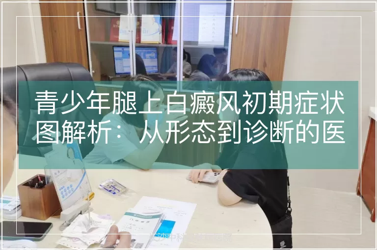 青少年腿上白癜风初期症状图解析：从形态到诊断的医学视角