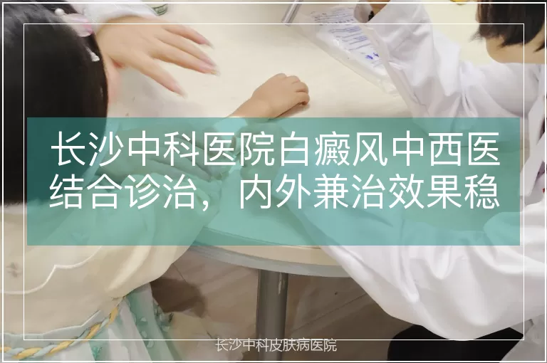 长沙中科医院白癜风中西医结合诊治，内外兼治效果稳固持久