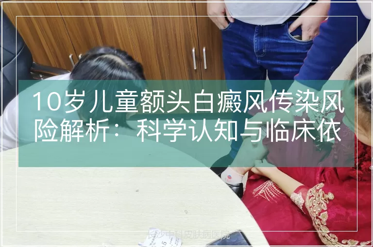 10岁儿童额头白癜风传染风险解析：科学认知与临床依据