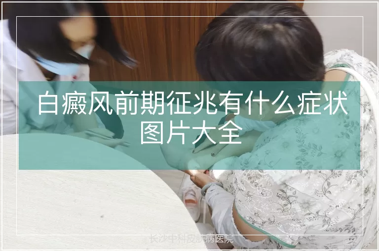 白癜风前期征兆有什么症状图片大全