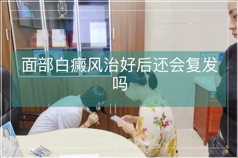 面部白癜风治好后还会复发吗