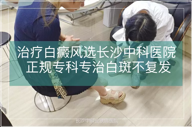 治疗白癜风选长沙中科医院 正规专科专治白斑不复发