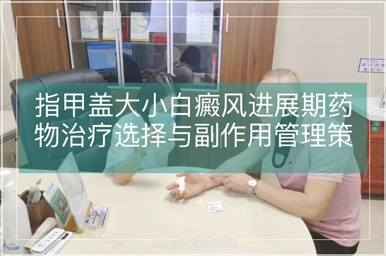 指甲盖大小白癜风进展期药物治疗选择与副作用管理策略