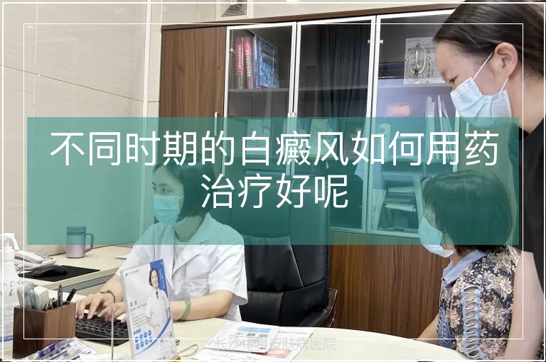 不同时期的白癜风如何用药治疗好呢