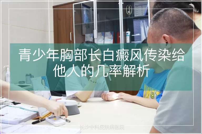 青少年胸部长白癜风传染给他人的几率解析