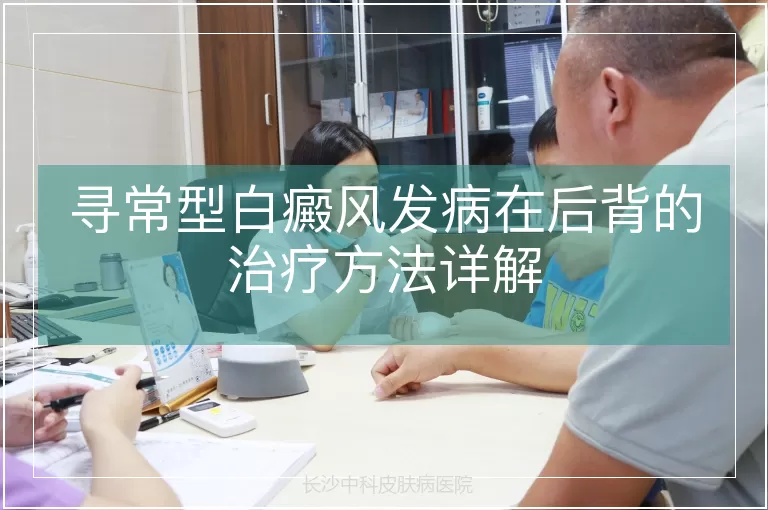 寻常型白癜风发病在后背的治疗方法详解