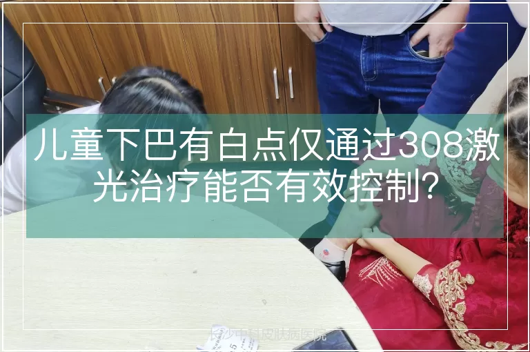 儿童下巴有白点仅通过308激光治疗能否有效控制?