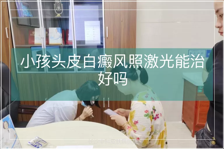 小孩头皮白癜风照激光能治好吗