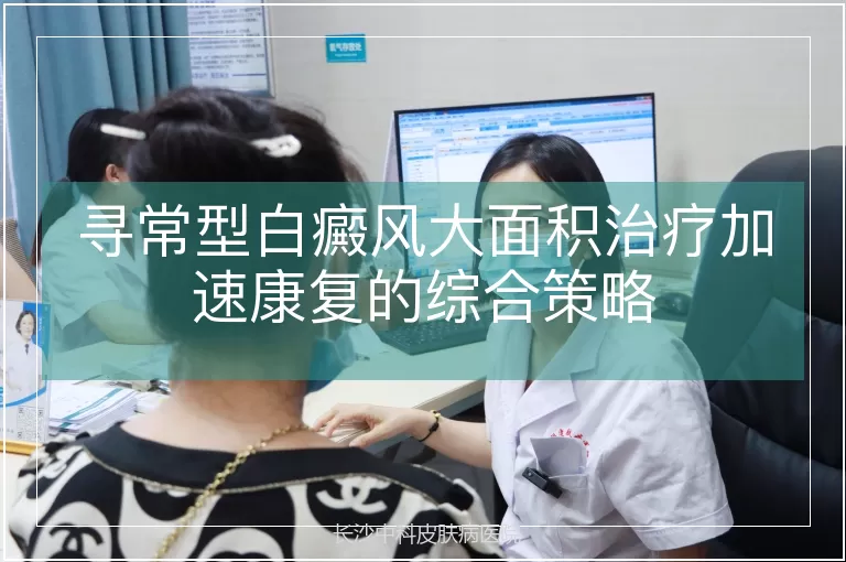 寻常型白癜风大面积治疗加速康复的综合策略