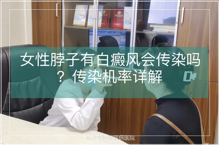 女性脖子有白癜风会传染吗?传染机率详解