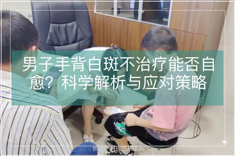 男子手背白斑不治疗能否自愈？科学解析与应对策略