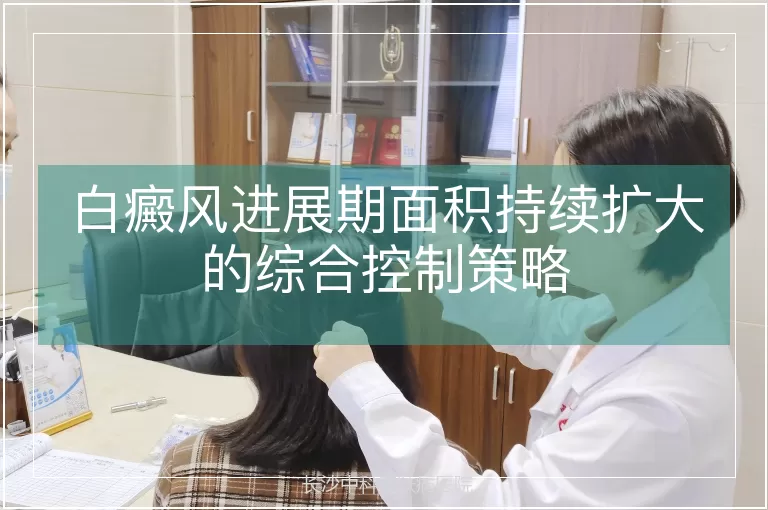 白癜风进展期面积持续扩大的综合控制策略