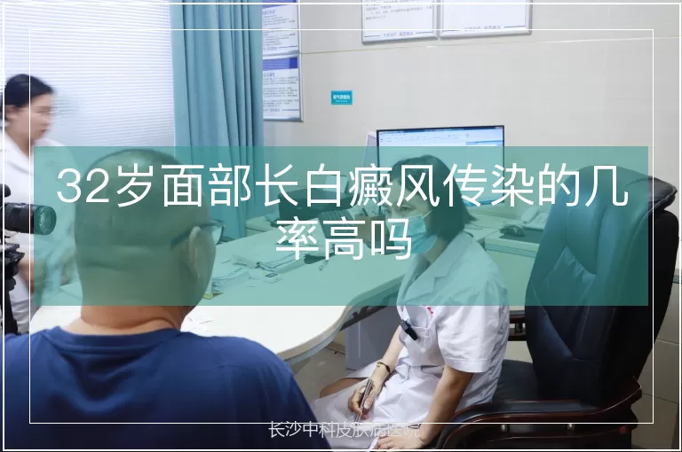 32岁面部长白癜风传染的几率高吗