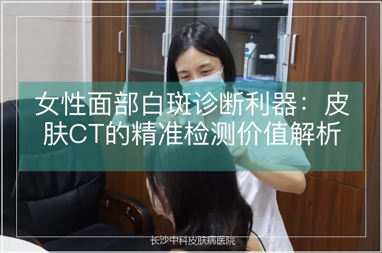 女性面部白斑诊断利器:皮肤CT的精准检测价值解析