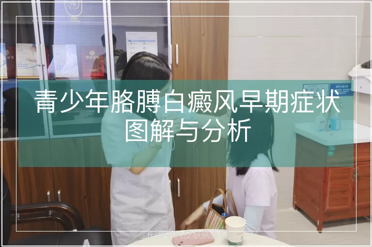 青少年胳膊白癜风早期症状图解与分析