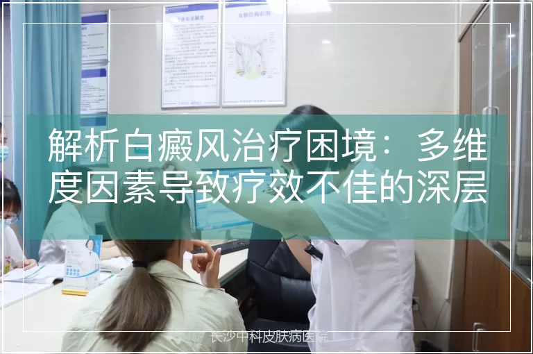 解析白癜风治疗困境:多维度因素导致疗效不佳的深层原因