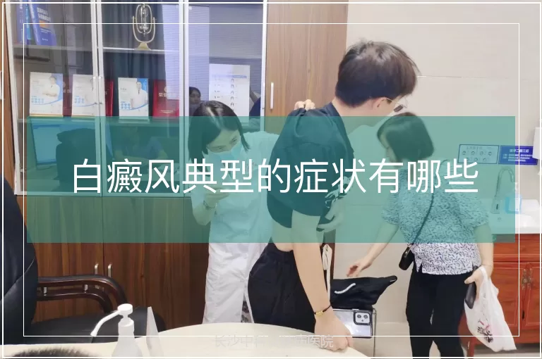 白癜风典型的症状有哪些