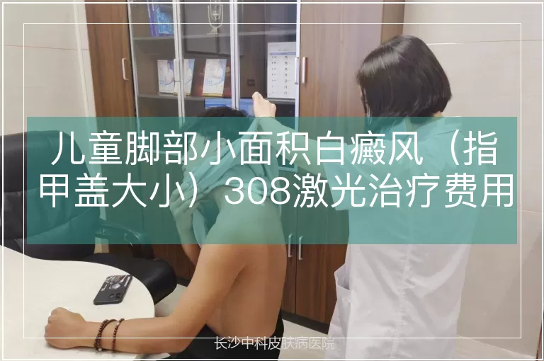 儿童脚部小面积白癜风（指甲盖大小）308激光治疗费用解析