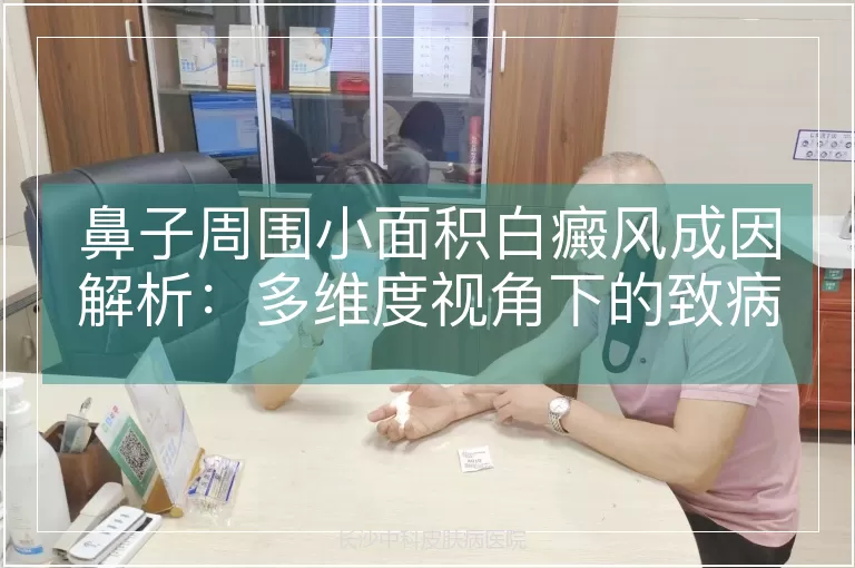 鼻子周围小面积白癜风成因解析：多维度视角下的致病机制