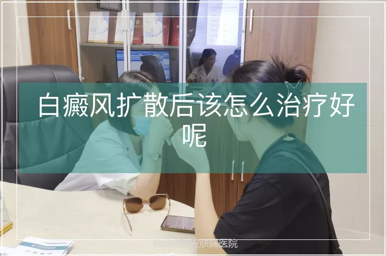白癜风扩散后该怎么治疗好呢