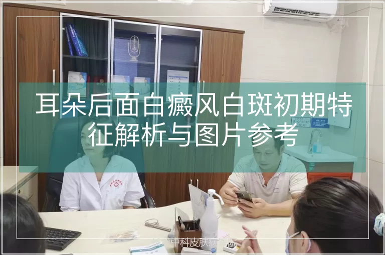 耳朵后面白癜风白斑初期特征解析与图片参考