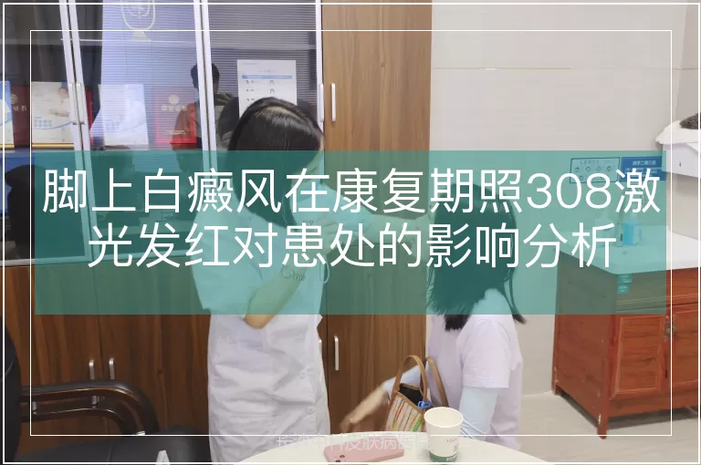 脚上白癜风在康复期照308激光发红对患处的影响分析