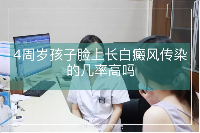 4周岁孩子脸上长白癜风传染的几率高吗