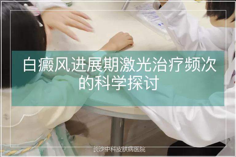 白癜风进展期激光治疗频次的科学探讨