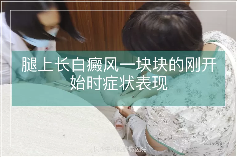 腿上长白癜风一块块的刚开始时症状表现