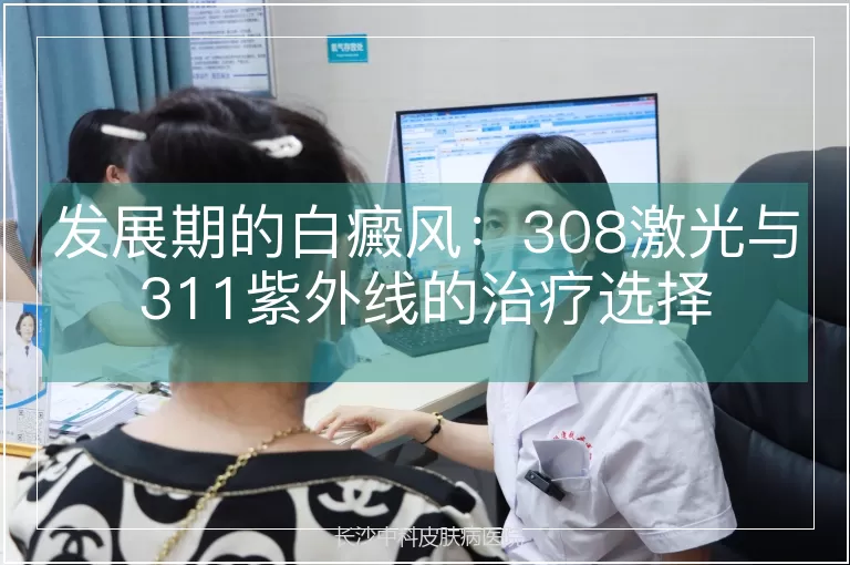 发展期的白癜风：308激光与311紫外线的治疗选择