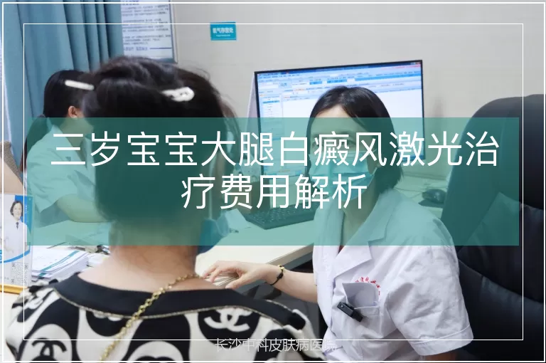 三岁宝宝大腿白癜风激光治疗费用解析