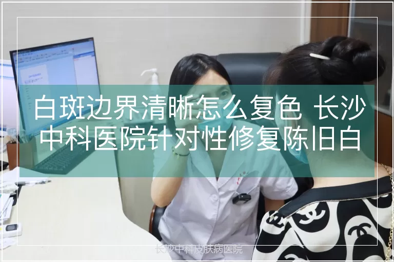 白斑边界清晰怎么复色 长沙中科医院针对性修复陈旧白斑