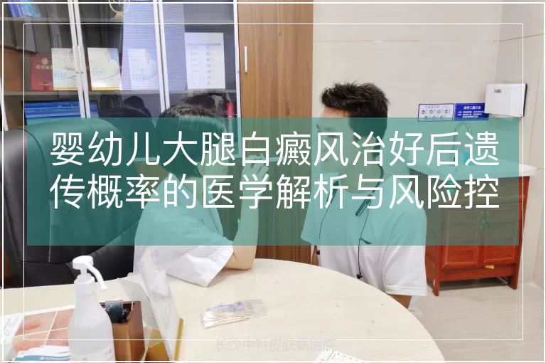 婴幼儿大腿白癜风治好后遗传概率的医学解析与风险控制