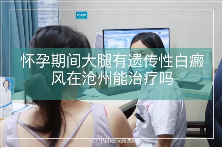 怀孕期间大腿有遗传性白癜风在沧州能治疗吗