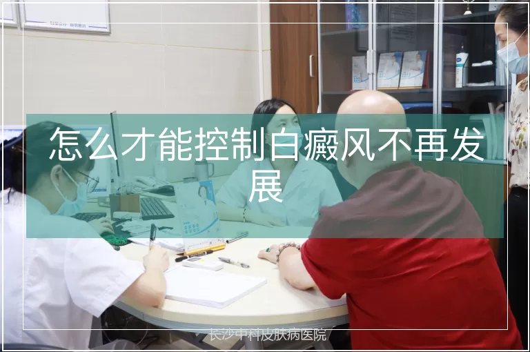 怎么才能控制白癜风不再发展