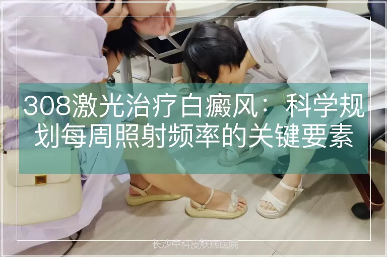 308激光治疗白癜风:科学规划每周照射频率的关键要素
