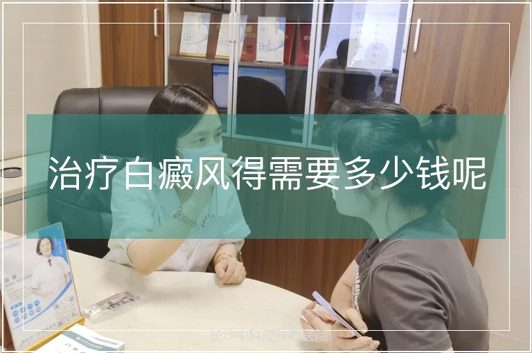治疗白癜风得需要多少钱呢