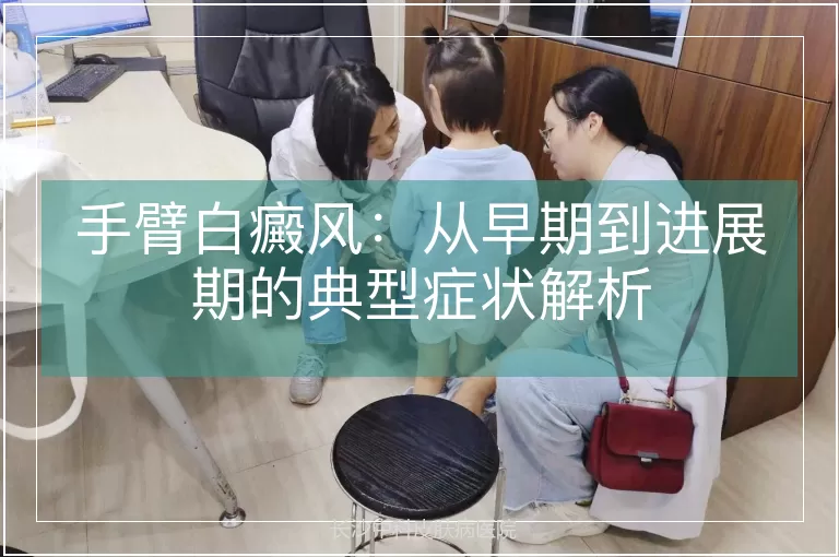 手臂白癜风：从早期到进展期的典型症状解析