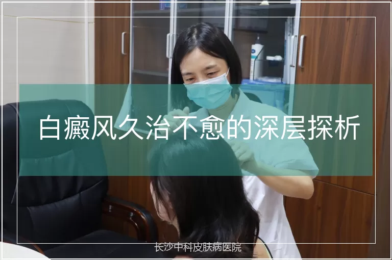 白癜风久治不愈的深层探析