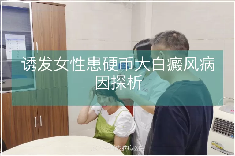 诱发女性患硬币大白癜风病因探析