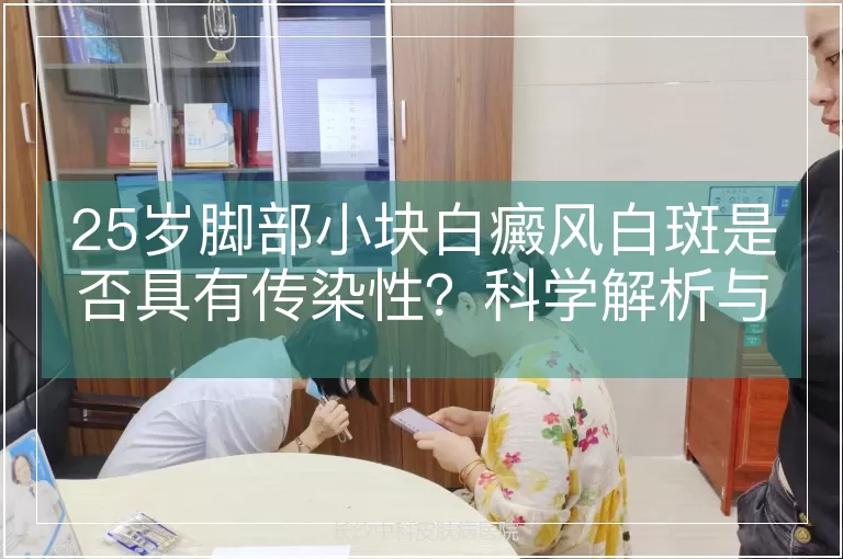 25岁脚部小块白癜风白斑是否具有传染性？科学解析与日常管理指南