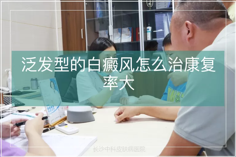泛发型的白癜风怎么治康复率大