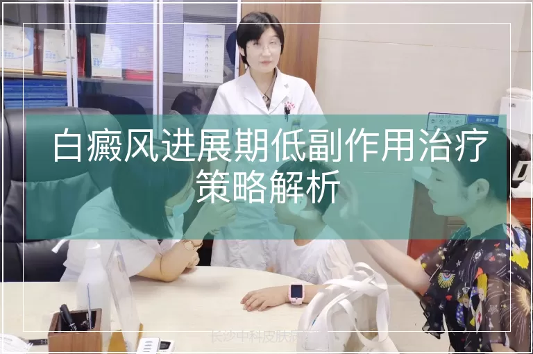 白癜风进展期低副作用治疗策略解析
