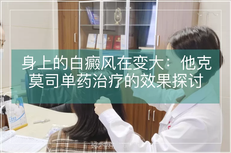 身上的白癜风在变大：他克莫司单药治疗的效果探讨