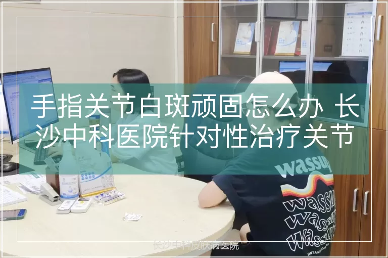 手指关节白斑顽固怎么办 长沙中科医院针对性治疗关节白癜风