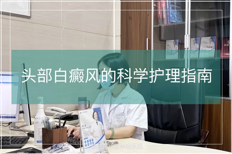 头部白癜风的科学护理指南