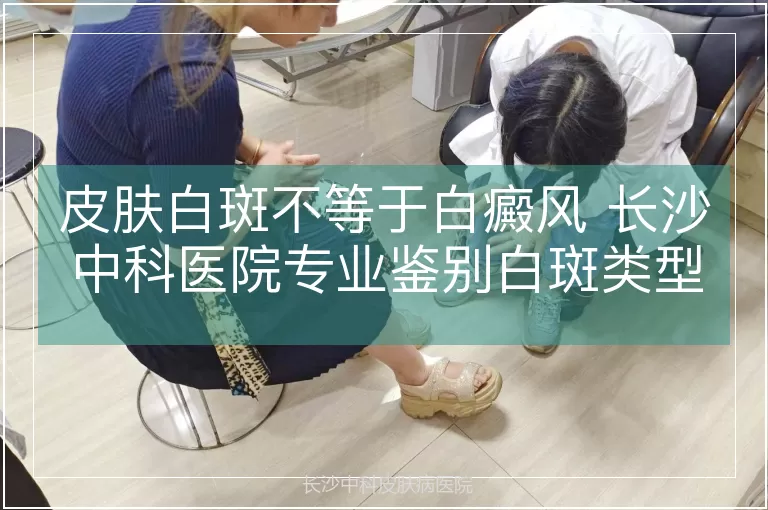 皮肤白斑不等于白癜风 长沙中科医院专业鉴别白斑类型