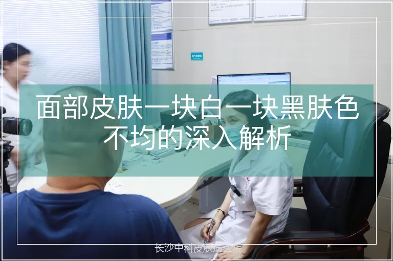 面部皮肤一块白一块黑肤色不均的深入解析