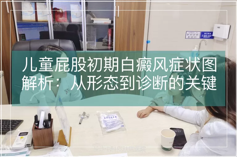 儿童屁股初期白癜风症状图解析:从形态到诊断的关键特征